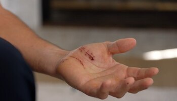 El incidente ocurrió durante una