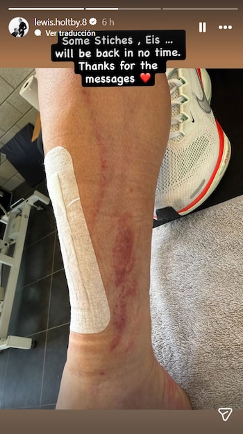 El posteo de Lewis Holtby tras la lesión que sufrió