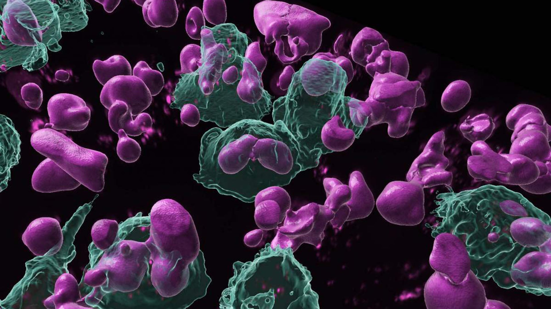 El estudio identificó células B de memoria reactivas al tumor en pacientes con cáncer de ovario seroso de alto grado. En la imagen, las células fagocíticas (verdes) engullen las células B activadas (rosas), suprimiendo así la respuesta inmunitaria local (Foto: Instituto Weizmann)