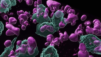 Memoria inmunológica contra el cáncer: hallan células capaces de “recordar” tumores y atacarlos con anticuerpos