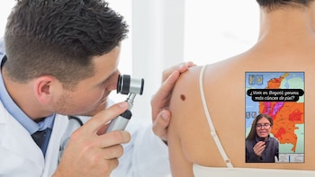Ojo con el sol, los habitantes de Bogotá tienen mayor riesgo de sufrir cáncer de piel: dermatóloga explica la razón