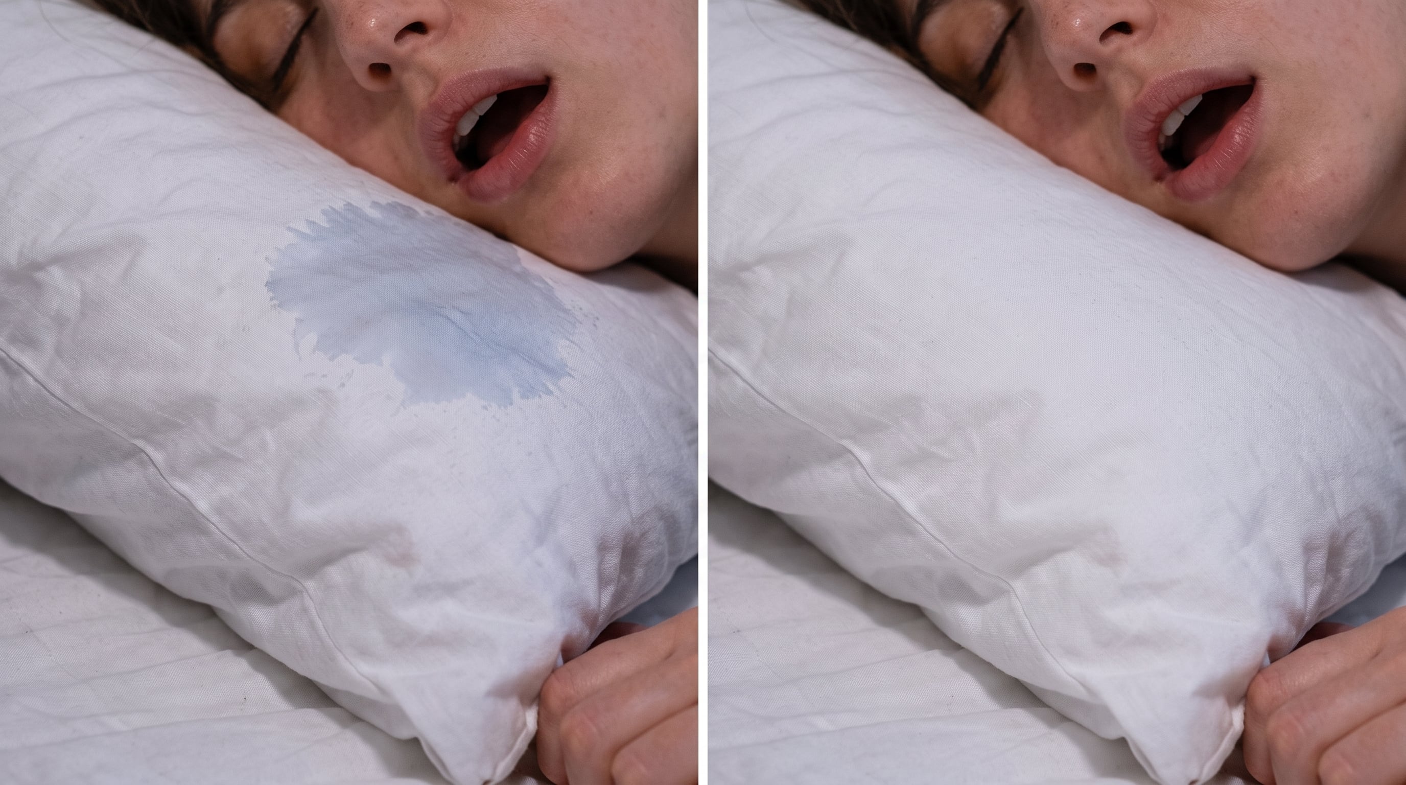 El olor a saliva aparece cuando bacterias descomponen proteínas sobre la tela húmeda. (Imagen Ilustrativa Infobae)