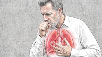 Por qué los hombres tienen más casos de tuberculosis que las mujeres, según un estudio internacional