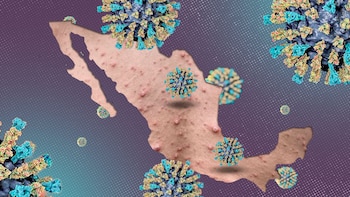 Por qué el sarampión reaparece