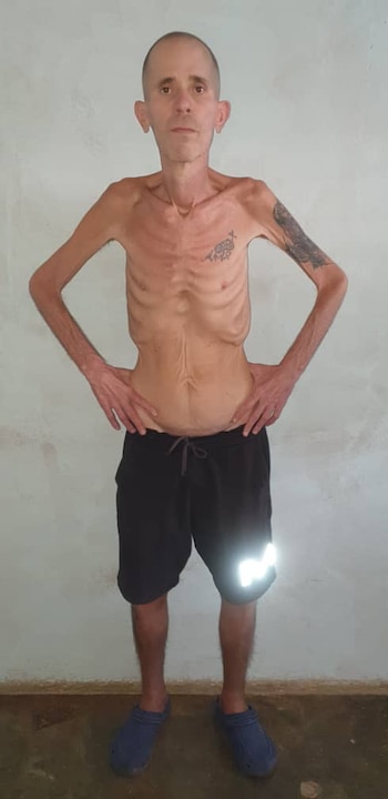 Hombre de tez clara y calvo, extremadamente delgado, de pie frente a una pared clara, con los brazos en las caderas, vistiendo shorts negros y sandalias azules