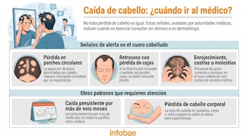 Infografía sobre caída de cabello mostrando patrones de pérdida en parches, retroceso capilar, enrojecimiento del cuero cabelludo, y pérdida de vello corporal.