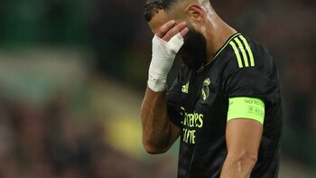 Alarma en Real Madrid y