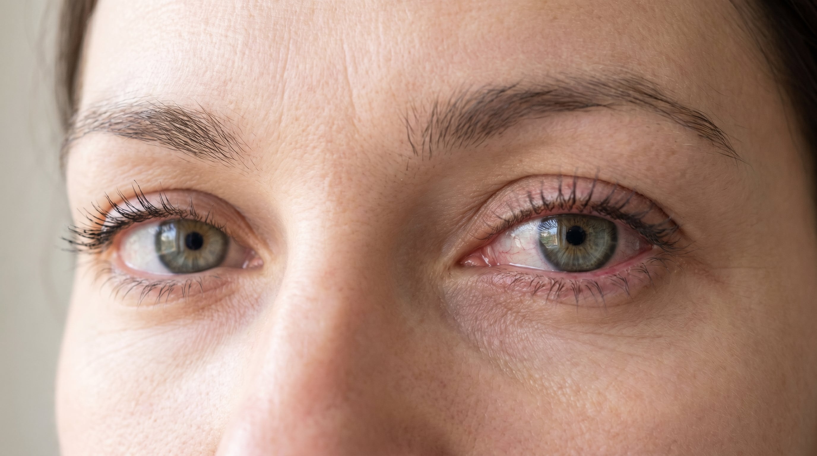 El hábito de frotar los ojos puede facilitar la transmisión de infecciones como la conjuntivitis, advierten organizaciones como Cleveland Clinic y Healthline (Imagen Ilustrativa Infobae)