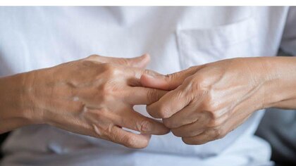 Artritis: qué es, causas, tipos, síntomas y tratamiento