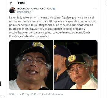 Trino de Polo Polo contra