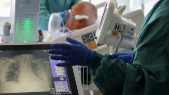 Menos fiebre, más tos e