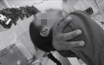 Niña fue brutalmente atacada por