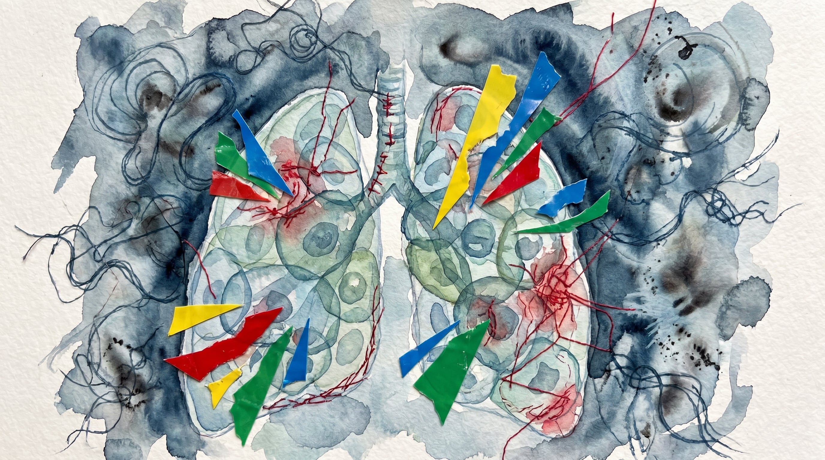 Una revisión de veinticinco estudios científicos registró microplásticos en sangre, secreciones respiratorias, órganos y tejido placentario (Imagen Ilustrativa Infobae)