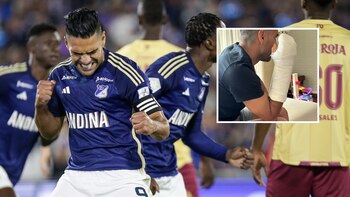 Millonarios recibió buenas noticias tras la fractura de Falcao: todo gracias a Dimayor