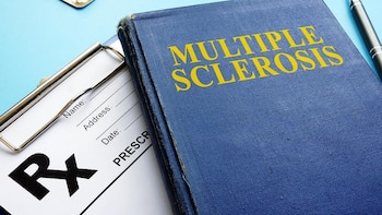 Un virus triplica el riesgo de EM, según un estudio.