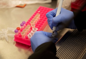 La enzima Falcipain-2 permite al parásito de la malaria digerir hemoglobina humana, lo que resulta esencial para su supervivencia dentro de los glóbulos rojos (REUTERS)