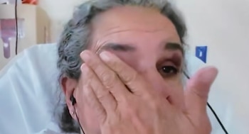 Primer plano de mujer con cabello gris en bata de hospital. Se cubre el ojo izquierdo con la mano, mientras el ojo derecho muestra una contusión. Lleva auriculares