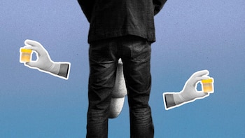 De qué color debe ser