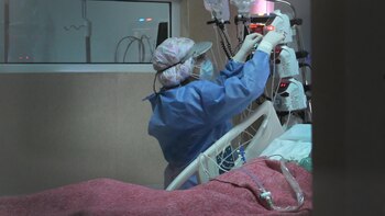 A diferencia de las variantes