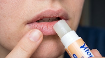 Primer plano de una persona aplicando bálsamo transparente en sus labios visiblemente resecos y agrietados, con un dedo cerca del labio inferior.