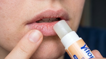 Labios partidos no son por falta de agua: especialista colombiano revela la verdadera causa y cómo solucionarlo desde adentro