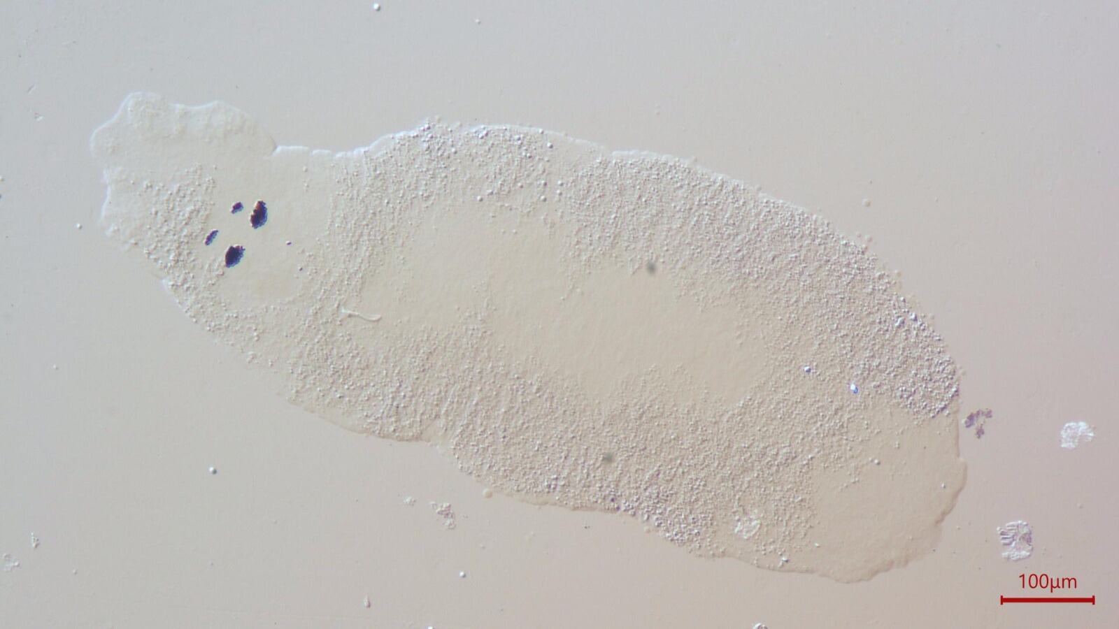 Parásito encontrado en