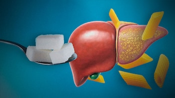El error común que no permite que se regenere tu hígado y avance la esteatosis hepática