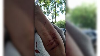 El ataque que habría sufrido