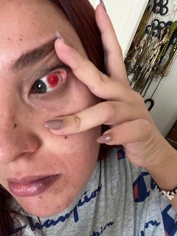 En diciembre tuvo un derrame