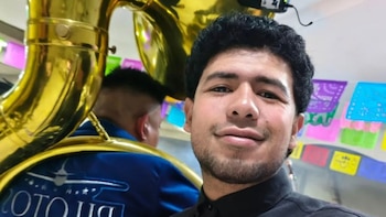 Balean en la cabeza a