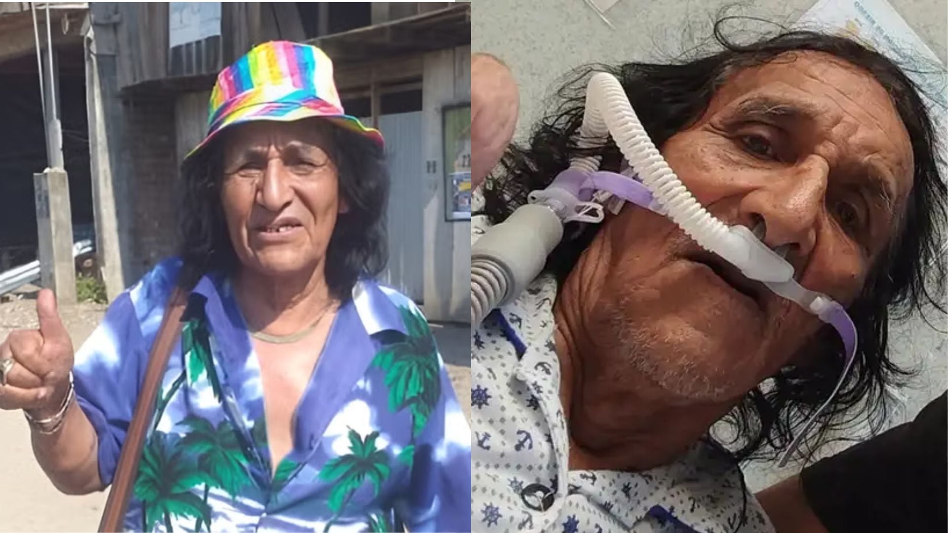 El comediante Lorenzo Zubiate, conocido como Mondonguito, se encuentra internado en estado delicado y conectado a asistencia respiratoria.