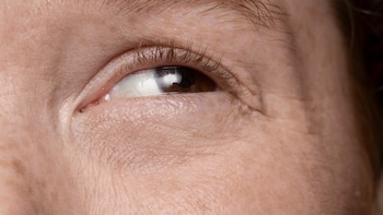 Mioquimias o pequeños temblores en el párpado: por qué aparecen, síntomas y tratamiento