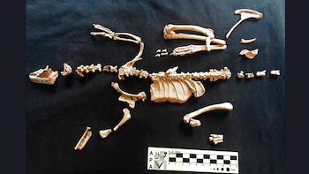 El estudio histológico revela que