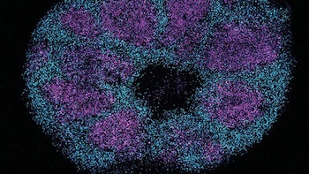 Un estudio de las proteínas cerebrales despierta optimismo ante nuevos tratamientos para el autismo