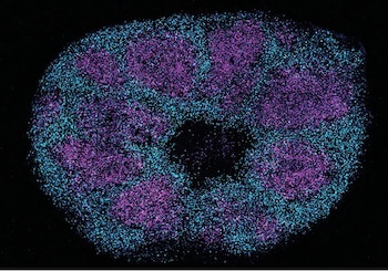 An image provided by the University of California, San Francisco, shows blue and purple colors marking different types of cells that develop in the fetal brain. Scientists have uncovered a wealth of clues about how genetic mutations lead to severe forms of autism, offering opportunities for testing drugs that could treat the condition, according to a study published Aug. 27, 2026. (University of California, San Francisco via The New York Times) — NO SALES; FOR EDITORIAL USE ONLY WITH NYT STORY SLUGGED SCI AUTISM RESEARCH BY CARL ZIMMER AND AZEEN GHORAYSHI FOR AUG. 27, 2026. ALL OTHER USE PROHIBITED. —