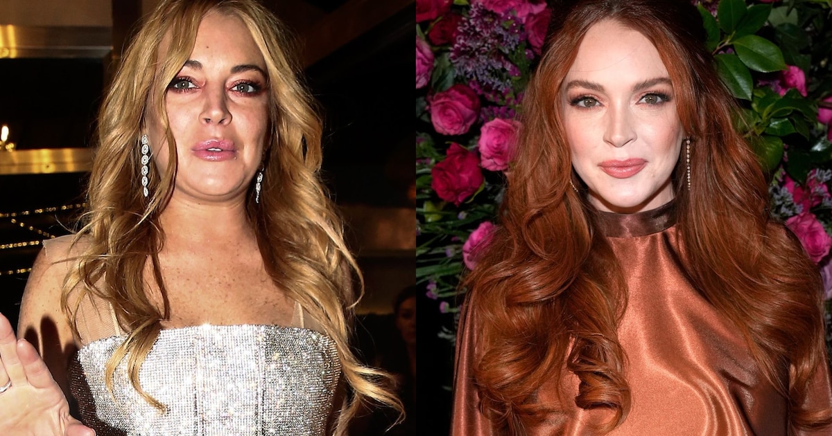 ¿Qué hay detrás del cambio radical de Lindsay Lohan? Cirujanos plásticos famosos hablan