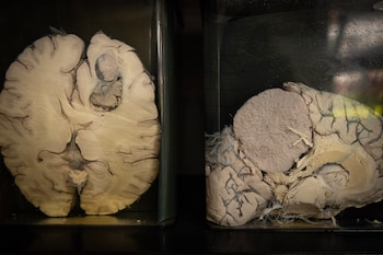 Museo del Cerebro