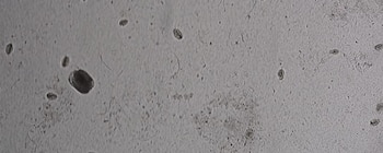 Microfotografía en escala de grises con microorganismos de distintos tamaños sobre un fondo claro e irregular