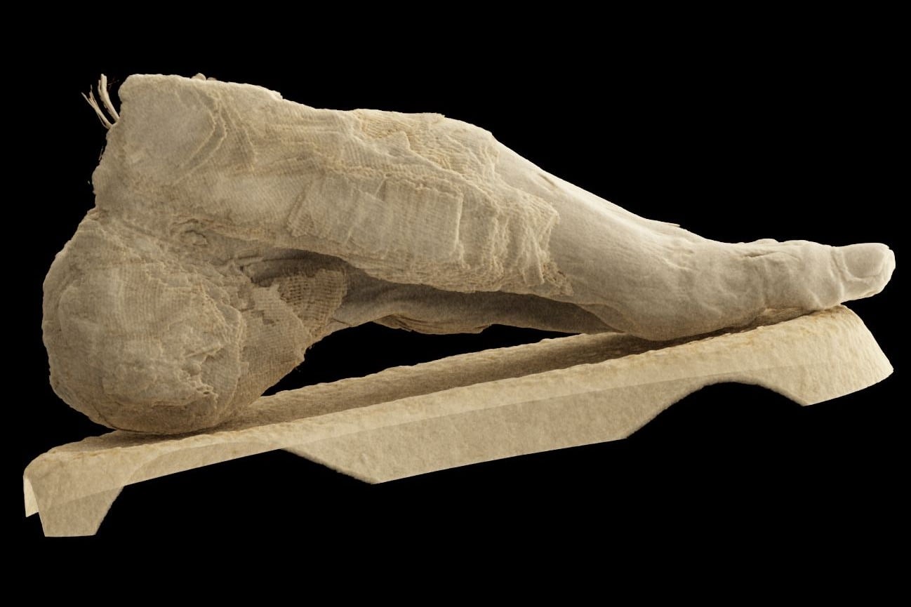 Las momias, incorporadas al museo tras su apertura en 1965, ya habían sido analizadas con métodos anteriores, aunque sin el nivel de detalle actual (Museo Nacional de Historia de la Medicina Semmelweis, MNMKK)