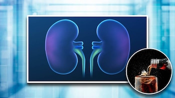 Este es el efecto que