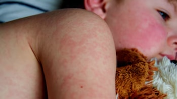 Las autoridades de Centroamérica advierten