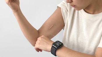 Un brazo humano con una marca de implante subcutáneo y un reloj inteligente en la muñeca que muestra un registro numérico y un gráfico.