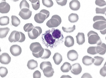 Capnocytophaga canimorsus