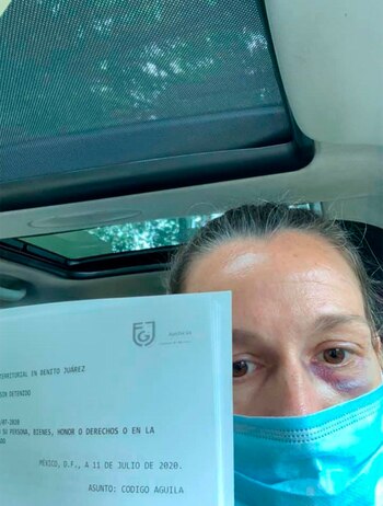 Claudia Revilla aseguró que había