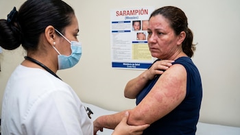 El Salvador eleva a 13 los casos de sarampión y refuerzan campaña de vacunación