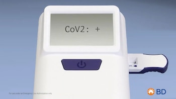 Este test tiene un costo