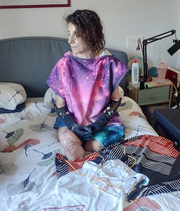 Rut Carpintero, que sufrió la