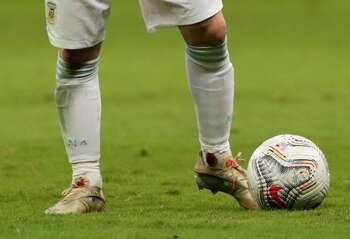 Así terminó el tobillo de Lionel Messi tras el planchazo de Frank Fabra (REUTERS/Henry Romero)