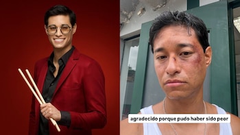 Tony Succar sorprende al aparecer con moretones en el rostro y explica la verdadera razón