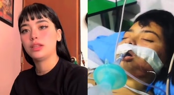 Las imágenes demuestran que las secuelas fueron bastante graves - crédito Paula Pardo / Instagram